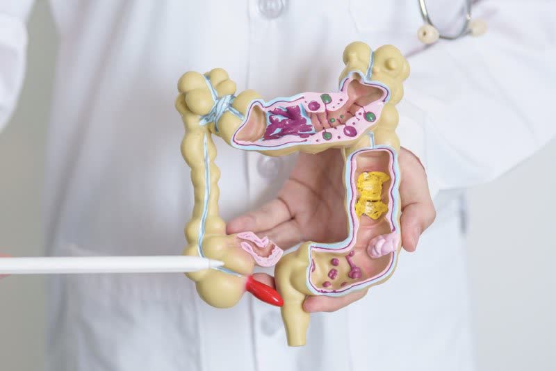 Illustrazione 3d di un addome per rappresentare l'appendicite